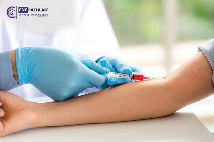Affordable Blood Test in dubai